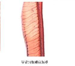 批木网-螺纹加厚